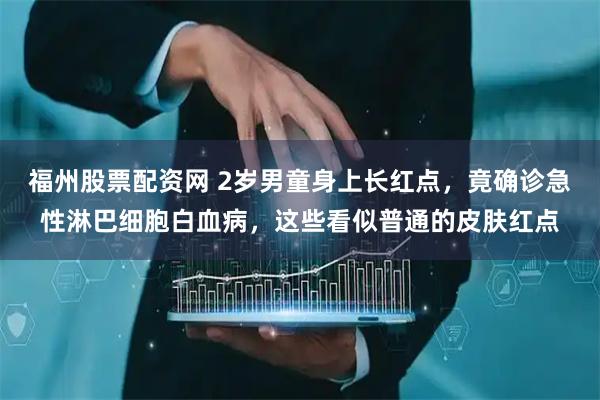 福州股票配资网 2岁男童身上长红点，竟确诊急性淋巴细胞白血病，这些看似普通的皮肤红点